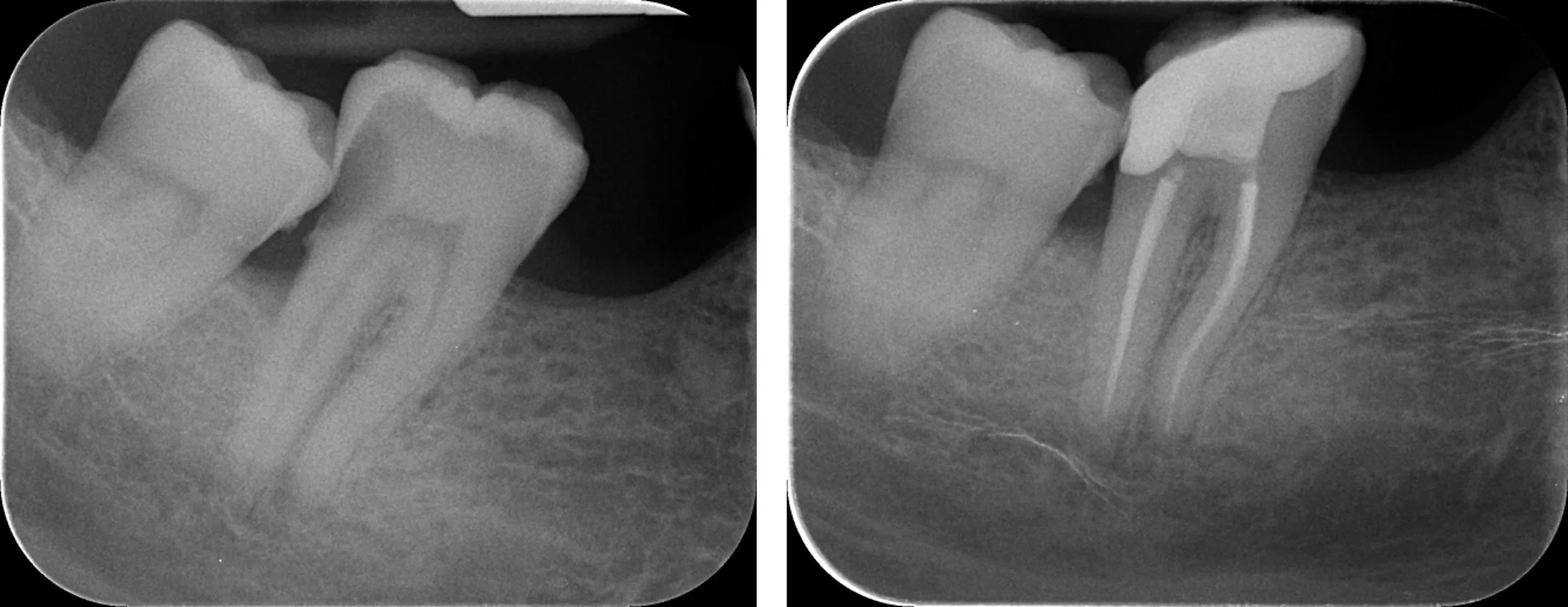 Restorability assessment